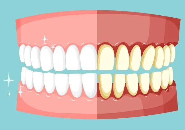 Czy wybielanie zębów przy użyciu popularnych produktów z drogerii rzeczywiście działa?